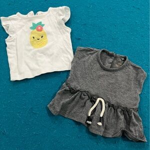 Gray top and pineapple shirt bundle